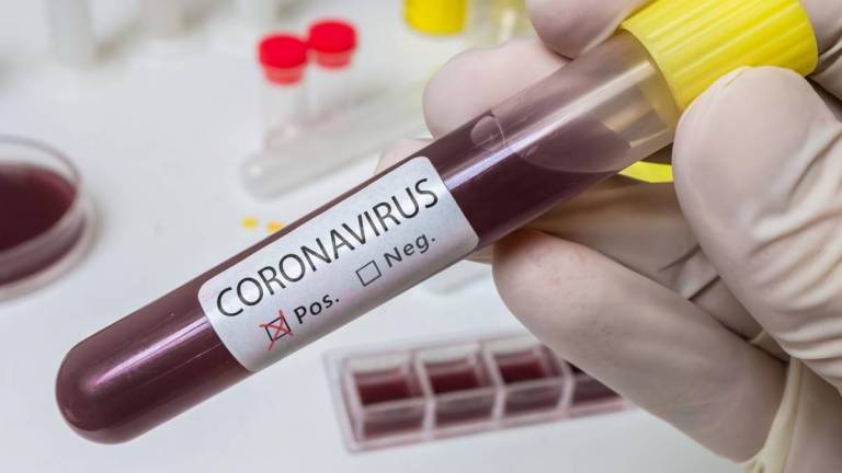 Coronavírus : Santa Catarina tem 975 casos e 32 mortes