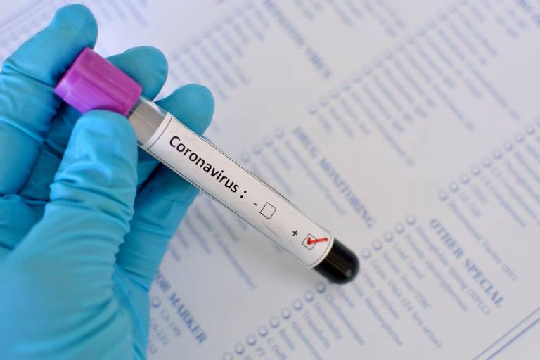 Prefeitura de Itapema divulga medidas de prevenção ao coronavírus