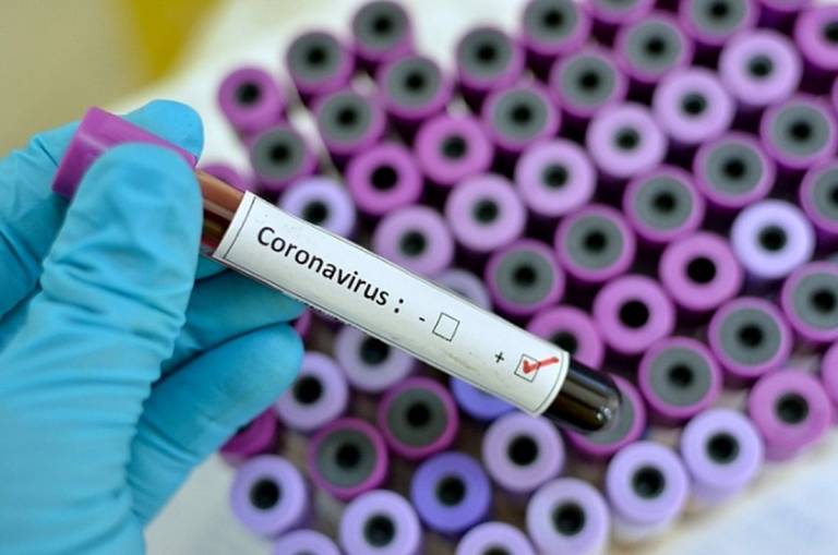 Confirmado sexto caso de coronavírus em Santa Catarina