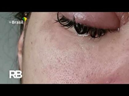 Verão é a época do ano em que aumentam os problemas nos olhos