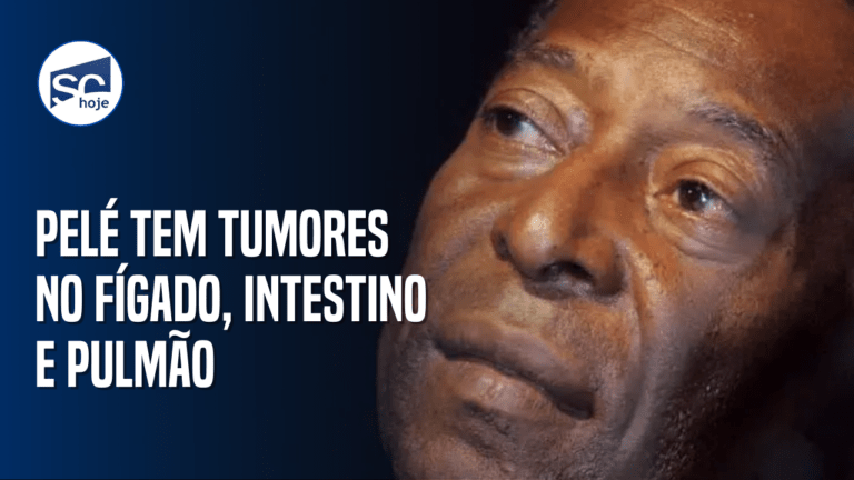 Pelé tem tumores no fígado, intestino e pulmão. Veja o vídeo!
