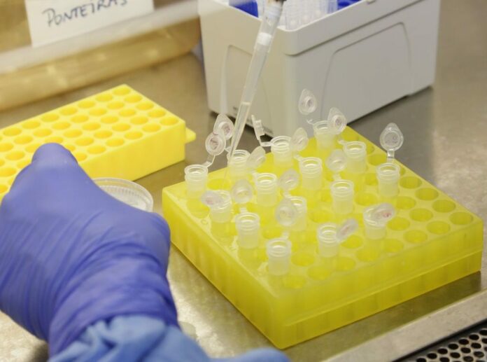 diagnostico-laboratorial-de-casos-suspeitos-do-novo-coronavirus-2801209410-1024x760